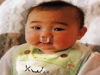 kule
